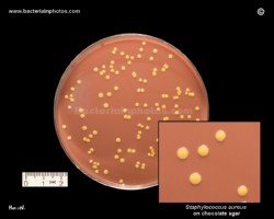 yellow colonies staph aureus on chocolate agar